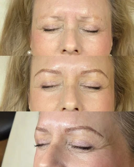 Before and after: Brows: before, during and after