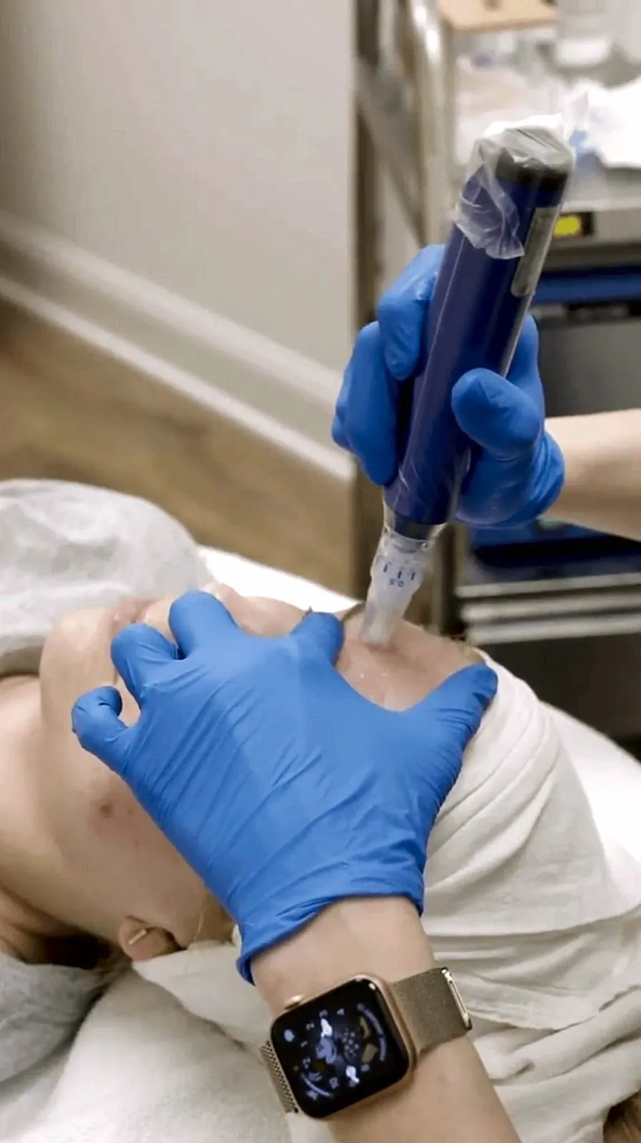 Microneedling at SpectacularSkin